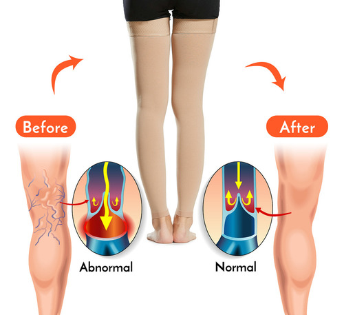 Calcetines De Compresión Para Hombre, Para Varices Y Mujeres