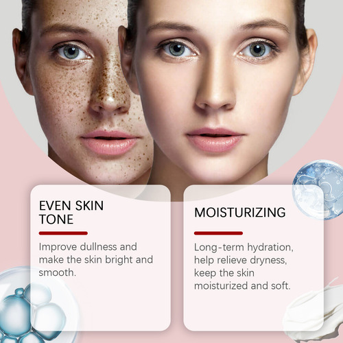 La Crema Blanqueadora Y Decoloración De Pecas R 577 Hidrata