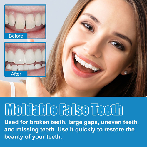Reparación De Dientes: Reparación Del Reemplazo De Dientes F