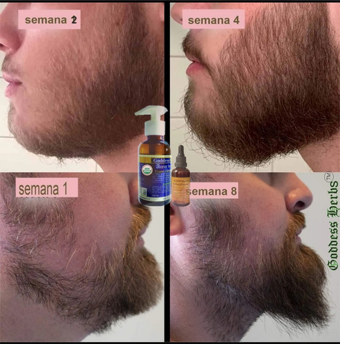 Pack Aceites Para Barba, Estimula Poblacion, Nutre Y Fortale