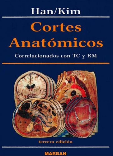 Cortes Anatómicos Correlacionados Con Tc Y Rm