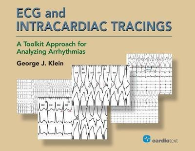 Ecg And Intracardiac Tracings : A Toolkit Approach For An...