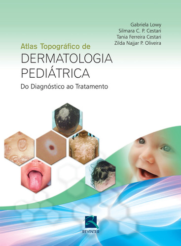 Dermatologia pediátrica, de Lowy, Gabriela. Editora Thieme Revinter Publicações Ltda, capa dura em português, 2015