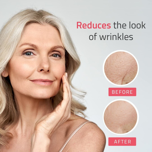 Suero Yeouth De Retinol 2.5 % Con Ácido Hialurónico, Aloe Ve