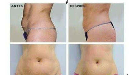 Imagen 6 de 10 de Maderoterapia Clases Taller Con Videos Maderas Incluidas