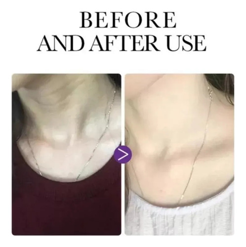 Crema Reafirmante De Colágeno Para El Cuello