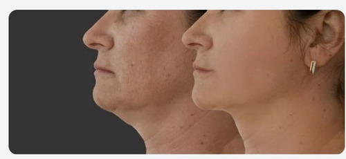 Crema Gel Lifting Masaje Reduce Papada Cuello 100% Natural
