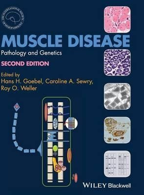 Muscle Disease - Hans H. Goebel