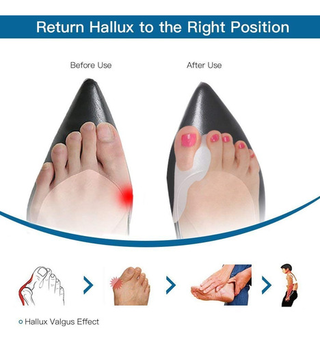 Corrector Juanete 2 Férulas Unitalla Flexible+ 2 Para Día