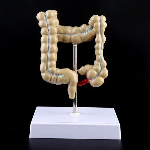 Para Para Modelo De Intestino Grueso Con Lesión De Colon