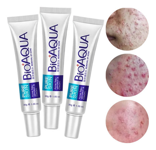 Paquete 3 Cremas Bioaqua Puntos Negros Anti Acne