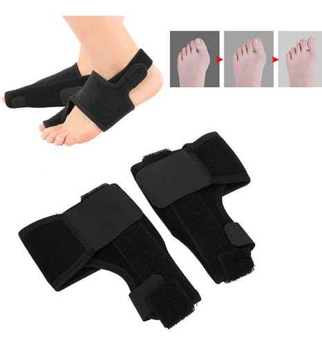 Protector Del Dedo Gordo Del Pie Suave Hallux Valgus Alisado