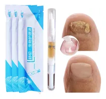 Comprar Elimina Hongos En Las Uñàs De Pie Y Mano, Suero Anti Hongos