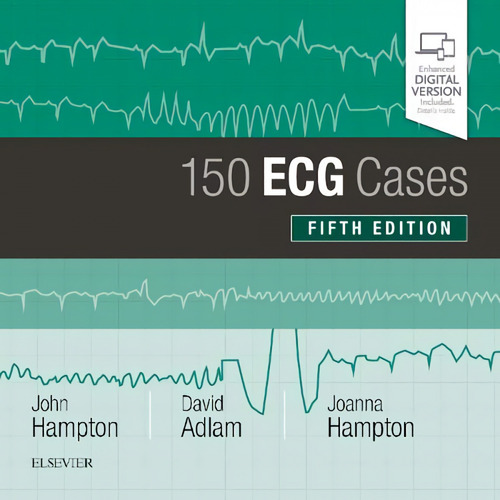 Libro 150 Ecg Cases - Hampton, Adlam