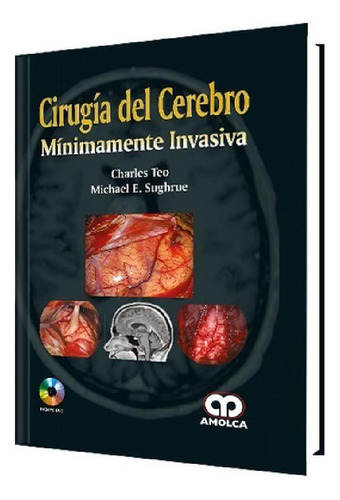 Libro - Cirugía Del Cerebro Minimamente Invasiva, De Charle