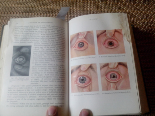 Gifford,a Textbook Of Ophthalmology (ilustrated).1938