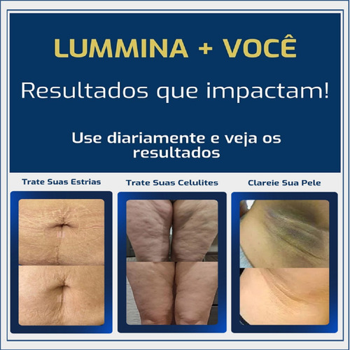 Creme Para Gestante/estrias/celulite/manchas Lummina Gest