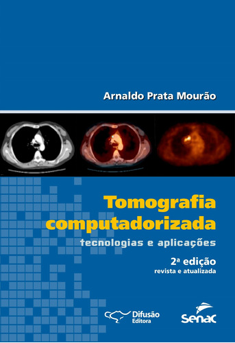 Tomografia computadorizada: tecnologias e aplicações, de Mourão, Arnaldo Prata. Difusão Editora Ltda.,SERVICO NACIONAL DE APRENDIZAGEM COMERCIAL - SENAC ARRJ,Difusão Editora, capa mole em português, 2015