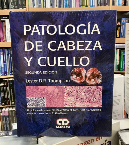 Patología De Cabeza Y Cuello 2da Ed. Thompson