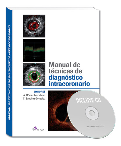 Libro Manual De Técnicas De Diagnóstico Intracoronario