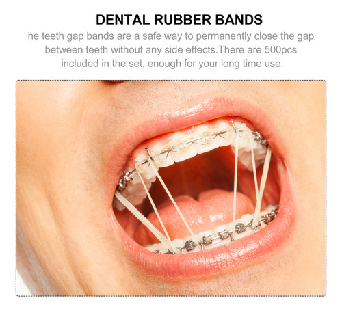 Ortodoncia Con Banda Elástica Dental, 500 Unidades