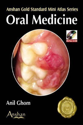 Mini Atlas Of Oral Medicine - Anil Ghom (paperback)