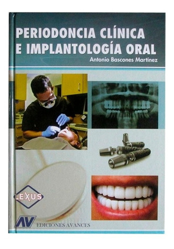 Periodoncia Clínica E Implantología Oral  Bascones