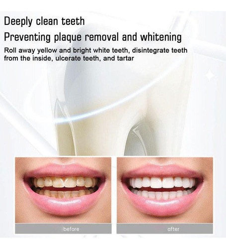 Pasta Dental De Probióticos Blanqueadora Sip-4, 2 Unidades