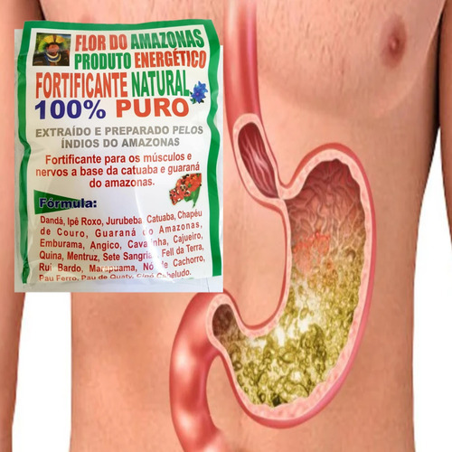 Cha Natural Intestino Preso Dor No Intestino De Barriga Full