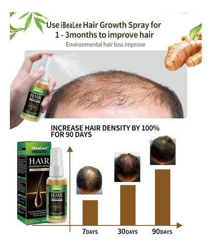 Calvície Tratamento Cura Cabelo Careca Freeshipping