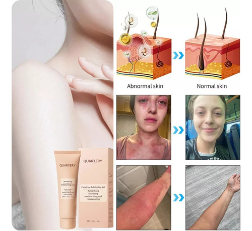 Paquete De 1 Unidad* Gel Exfoliante Purificador Quarxery Exf