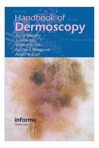Libro: Manual De Dermatoscopia