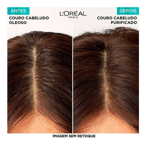 Kit Elseve Pure Hialurônico Shampoo Micelar Antioleosidade