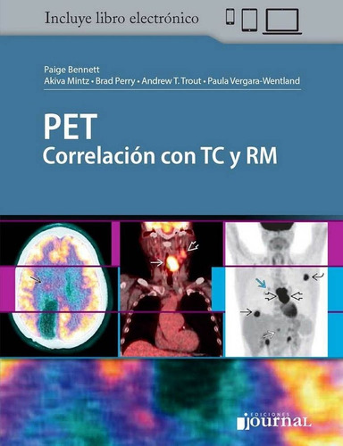 Pet Correlación Con Tc Y Rm