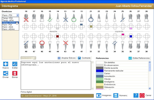 Demostracion Software Odontologos Dentogramas Envio Digital