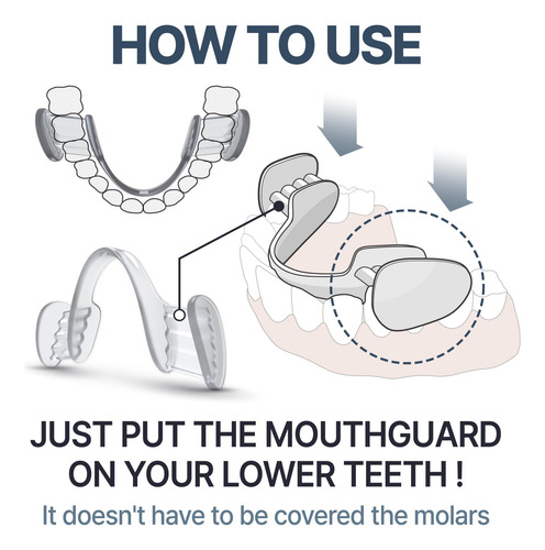Protector Bucal Para Rechinar Y Apretar Los Dientes Por La N
