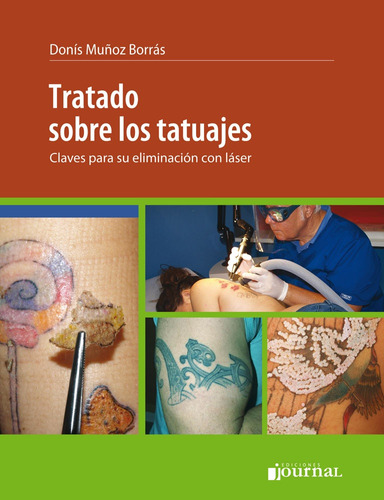 Tratado Sobre Los Tatuajes - Muñoz Borras, Donis