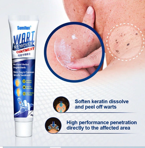 1 Peças De Creme De Remoção Instantânea De Manchas Removedor