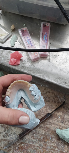 Prótesis Dental En El Día!!!! Consultanos Sin Costo