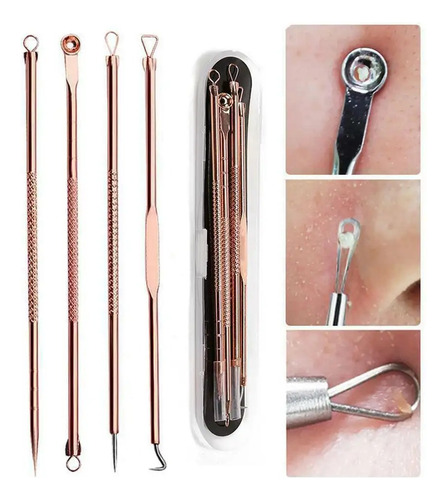 Set X 4 Herramientas Saca Comedones Removedor Puntos Negros