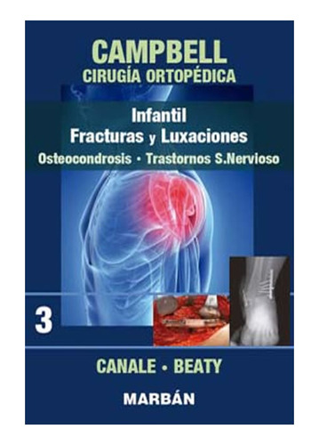 Campbell Cirugia Ortoped T 3 Infantil Fracturas Luxaciones