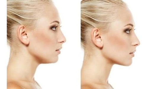 Tensor Anti Papada Unica Crema Reductora Hombre Mujer Pack 4