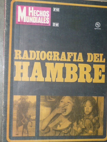 Radiografia Del Hambre