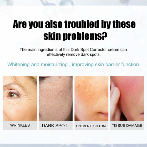 Crema Correctora E Antimanchas Para Rostro Y Cuerpo Age S
