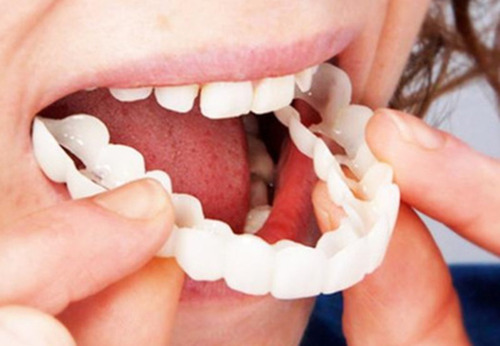 Imagen 4 de 5 de Sonrisa Perfecta Dentadura Dientes Blancos Relucientes Minut