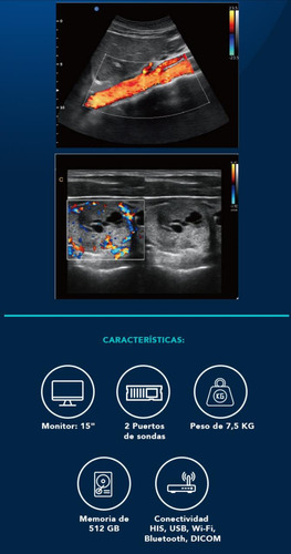 Ecografo Portátil Chison Ebit 50 , 3 Transductores 