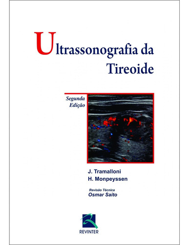 Ultrassonografia Da Tireoide