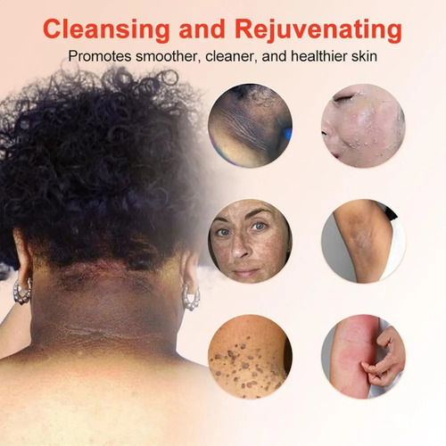 Gel Purificador Exfoliante Query, Exfoliante, 3 Unidades Roj