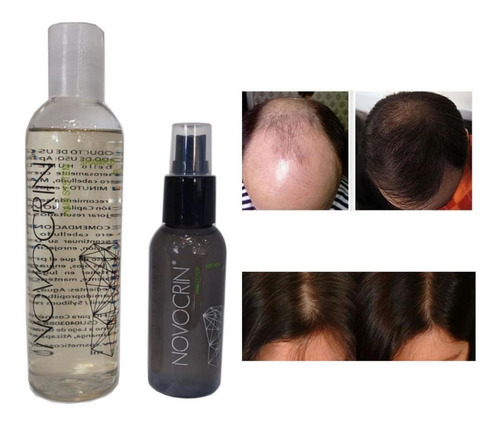Tratamiento Reparador De Cabello, Mxhgo-003, 3xshampoo 250ml