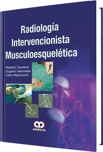 Radiología Intervencionista Musculoesquelética